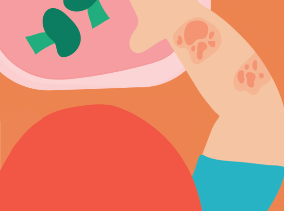 How Do You Know If Your Child Is Allergic or Intolerant to a Food?